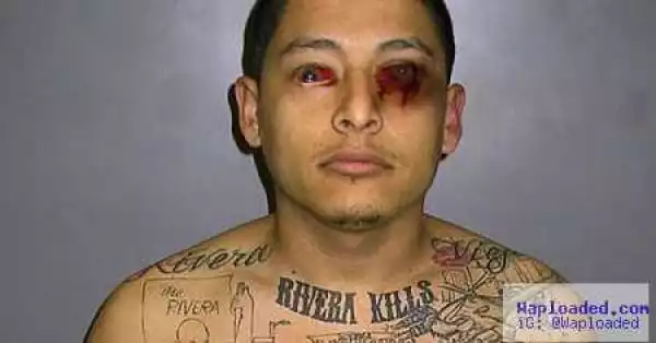 Omg! Gangster Goes Blind After Tattooing His Own Eyeballs (Photos)